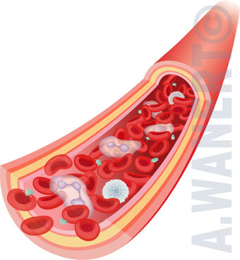 Hématologie